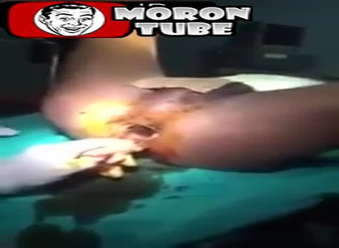 Video :Deep into her rectum, doctors detect something shocking